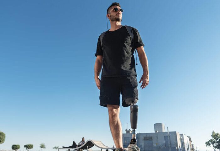 חזרתי הביתה עם רגל תותבת וגיליתי שאשתי עזבה אותי עם התאומים שזה עתה נולדו – אבל הקארמה נתנה לי הזדמנות לפגוש אותה שוב שלוש שנים מאוחר יותר.